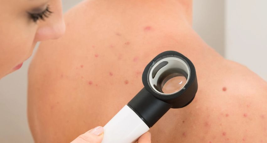 Expert Allergy Treatment in Mumbai by Dr. Shruti Sharma