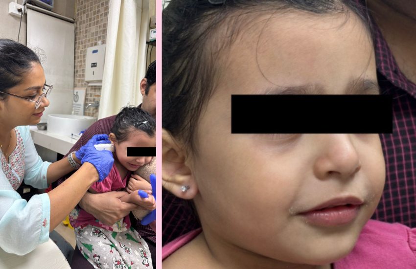 Dr. Shruti Sharma, ENT specialist doctor is trained and qualified to perform Ear Piercing procedures at (Pedder Road and Tardeo) Mumbai.